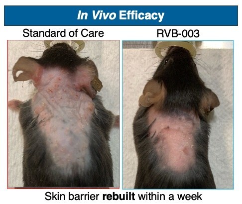 Representative images of Netherton Syndrome mice treated daily with either standard of care (left) or RVB-003 (right). Mice treated with RVB-003 show resolution of excessive protease activity, normalization of inflammation, marked reduction in epidermal hyperplasia, and ultimately a restoration of a healthy skin barrier.
